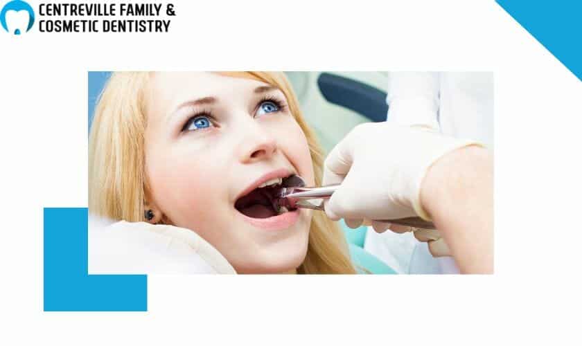 Tooth-Extraction