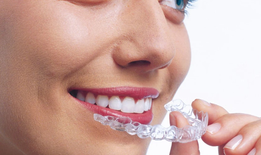 Invisalign Braces - Centreville Family and Cosmetic Dentistry