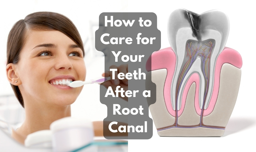 How to Care for Your Teeth After a Root Canal
