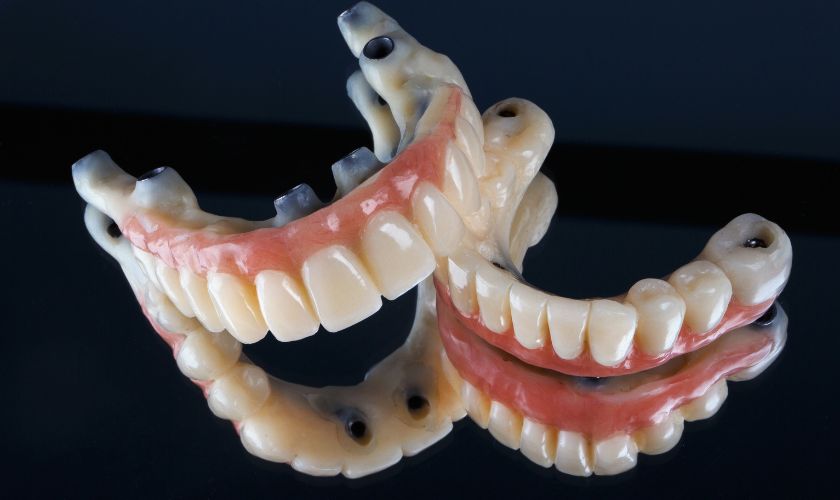 a comprehensive guide on full arch dental implants