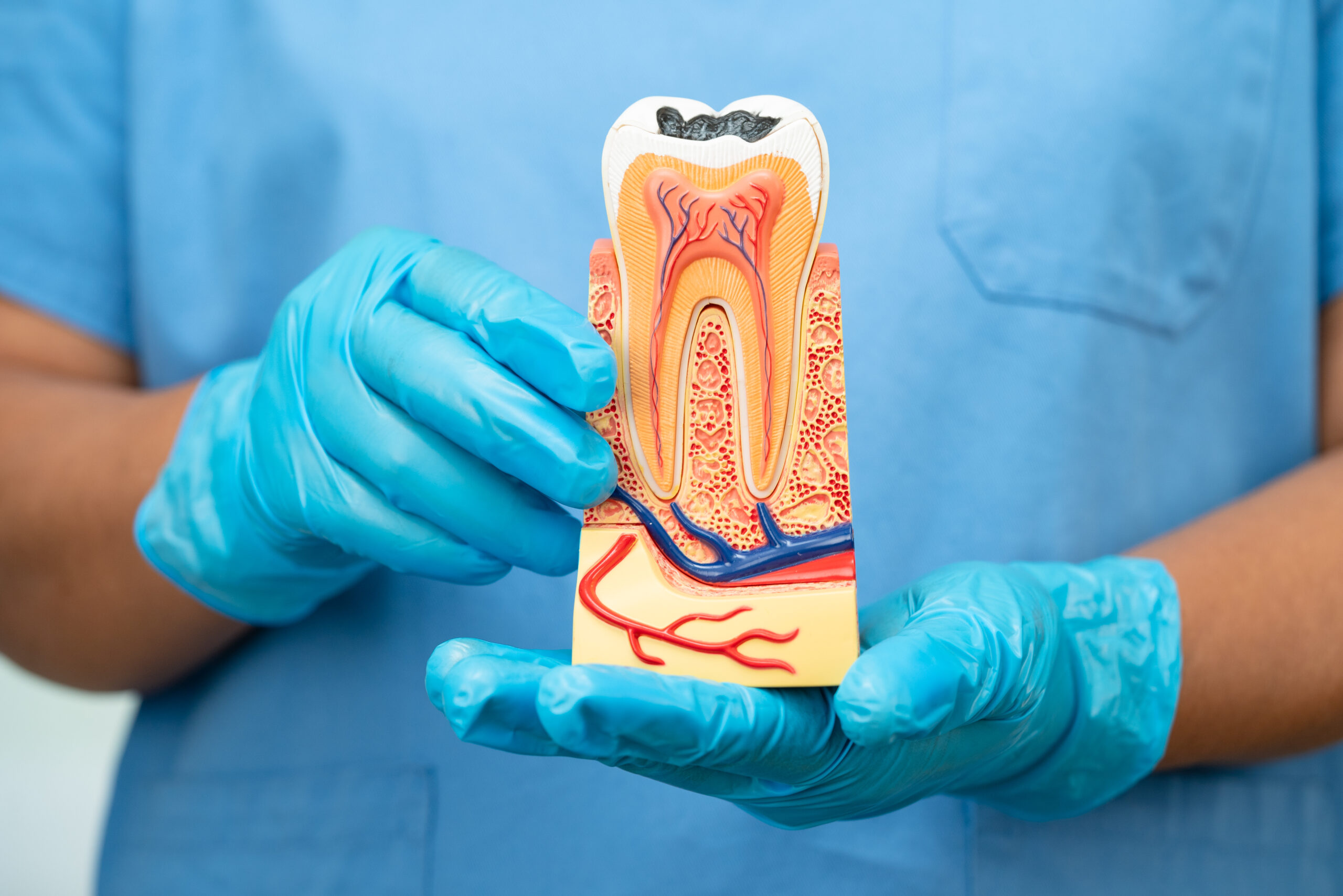 Tips for a Smooth Root Canal Recovery