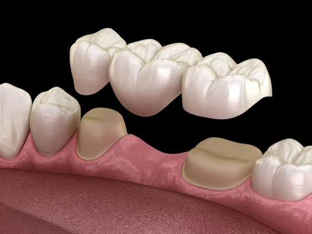 best dental bridge in centreville (2026)