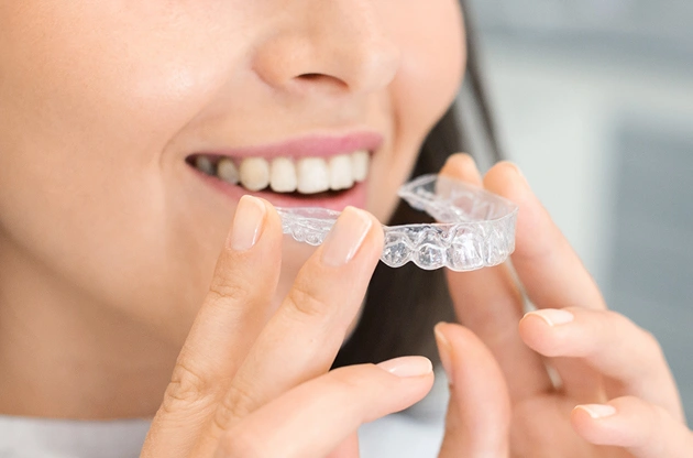 invisalign in centreville