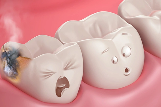 tooth cavities treatment in centreville, va
